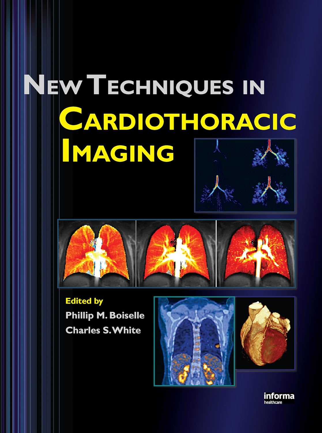 Buy New Techniques in Cardiothoracic Imaging (English, Paperback, Phillip M. Boiselle, Charles S. White) Online at Best Price - GlowMirror
