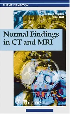 Buy Normal Findings in Ct and Mri (Thieme Flexibook) (English, Paperback, Torsten Moeller, Emil Reif) Online at Best Price - GlowMirror
