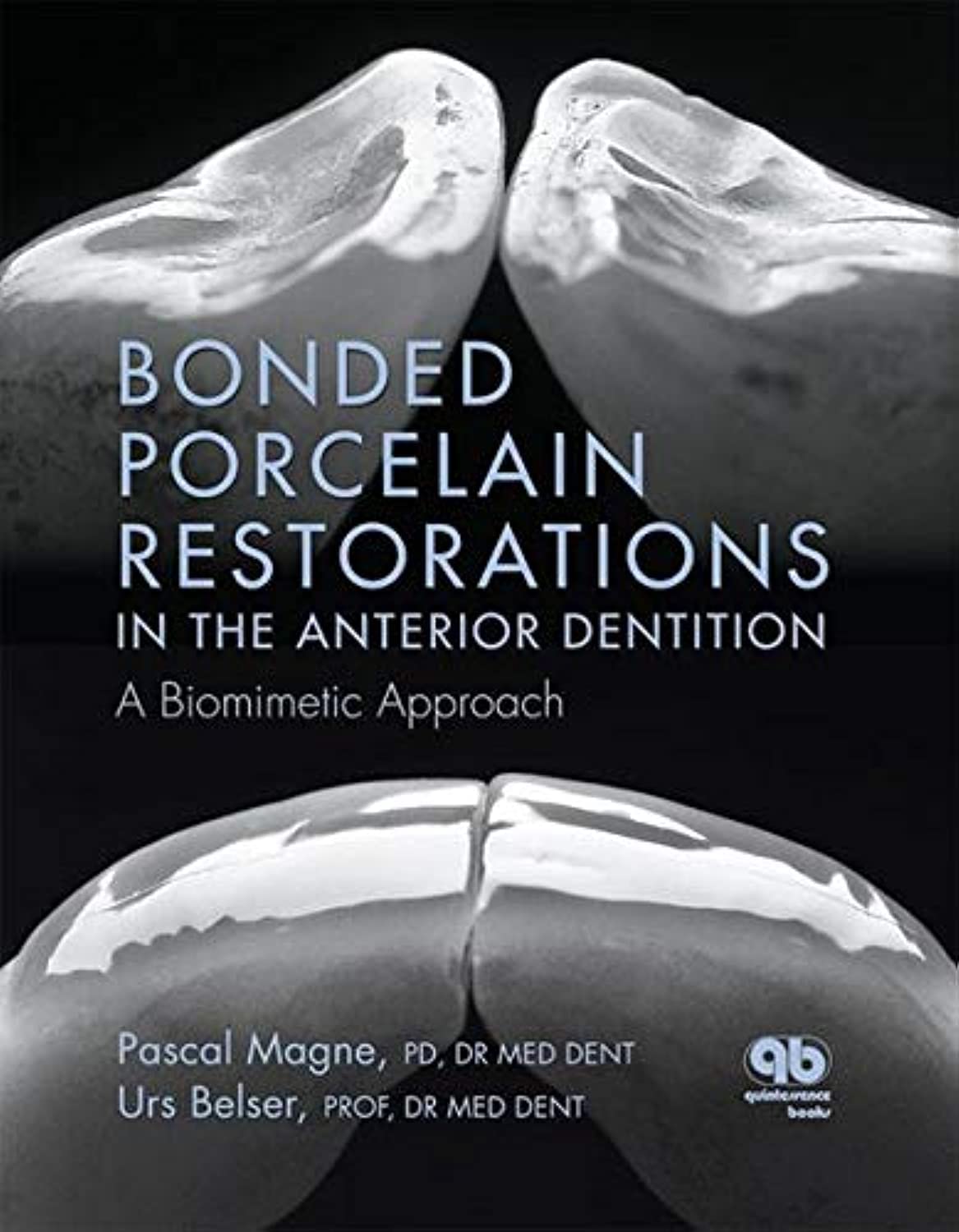 Buy Bonded Porcelain Restorations in the Anterior Dentition: A Biomimetic Approach (English, Paperback, Pascal Magne, U. Belser) Online at Best Price - GlowMirror