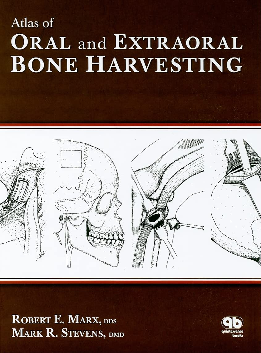 Buy Atlas of Oral and Extraoral Bone Harvesting (English, Hardcover, Robert E. Marx, Mark R. Stevens) Online at Best Price - GlowMirror