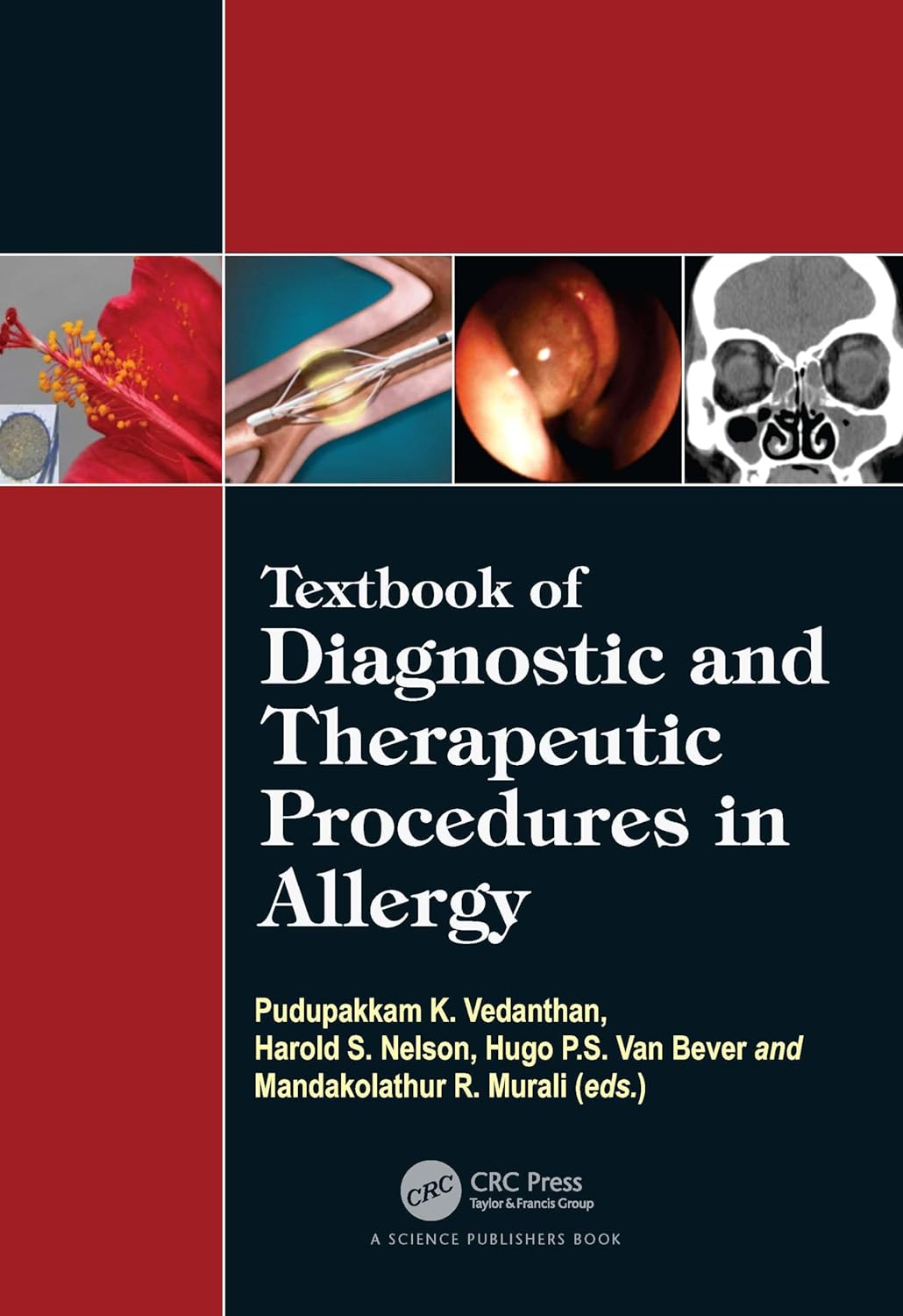 Buy Textbook of Diagnostic and Therapeutic Procedures in Allergy (English, Paperback, Pudupakkam K. Vedanthan, Harold S. Nelson, Hugo Van Bever, Mandak... Online at Best Price - GlowMirror