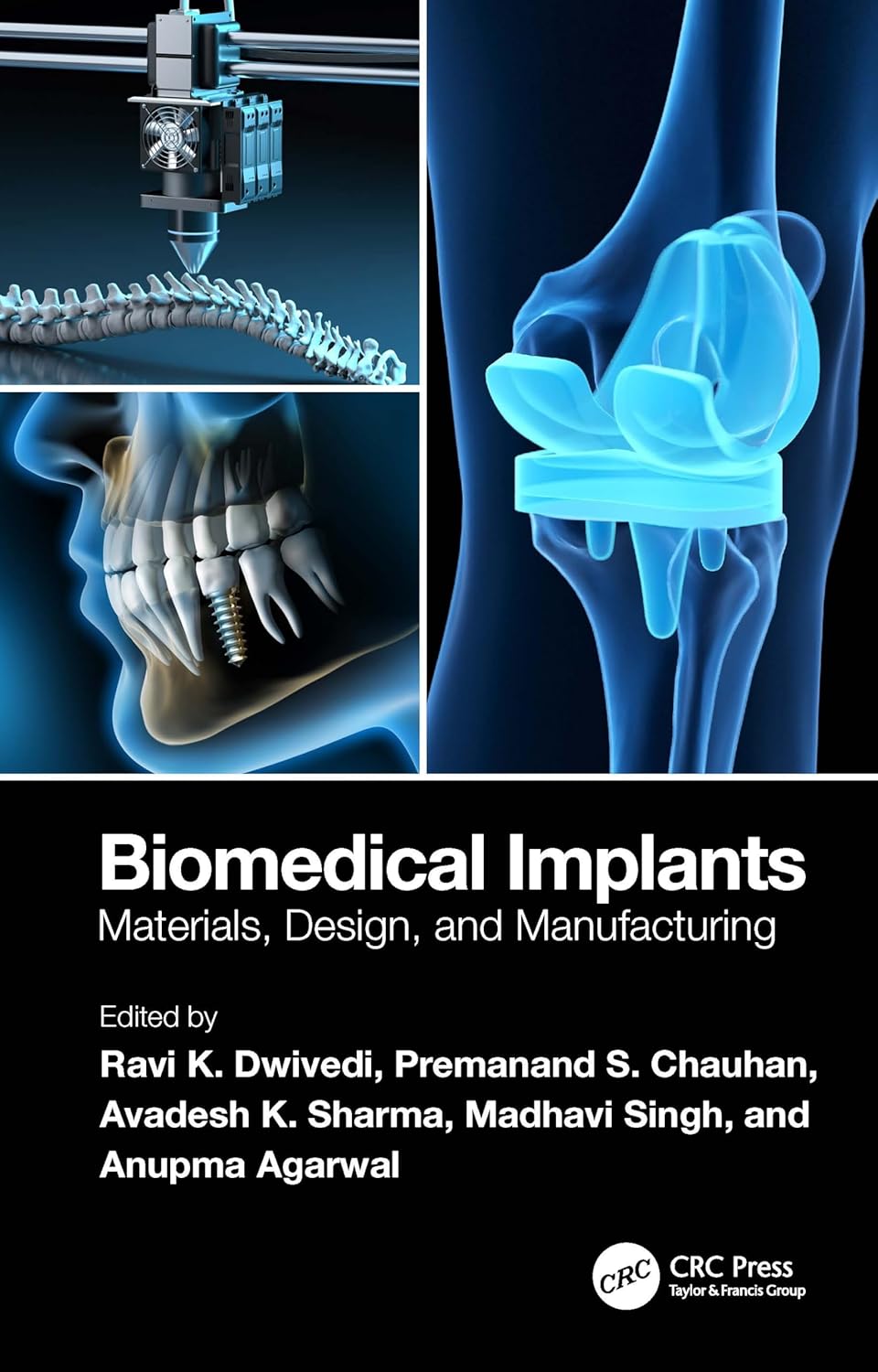 Biomedical Implants: Materials, Design, and Manufacturing (English, Paperback, Ravi K. Dwivedi, Premanand S. Chauhan, Avadesh K. Sharma, Madhavi Si... - Image 1 - GlowMirror