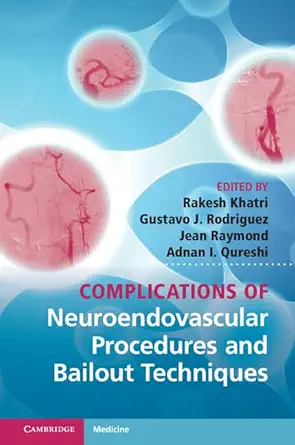 Buy Complications of Neuroendovascular Procedures and Bailout Techniques (English, Paperback, Rakesh Khatri, Gustavo J. Rodriguez, Jean Raymond, Adnan ... Online at Best Price - GlowMirror