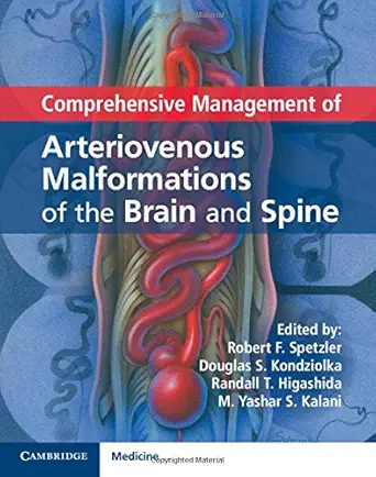 Buy Comprehensive Management of Arteriovenous Malformations of the Brain and Spine (English, Paperback, Robert F. Spetzler, Douglas S. Kondziolka, Rand... Online at Best Price - GlowMirror