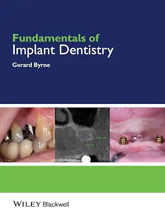 Buy Fundamentals of Implant Dentistry (English, Paperback, Gerard Byrne) Online at Best Price - GlowMirror