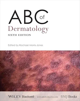 Buy ABC of Dermatology (ABC Series) (English, Paperback, Rachael Morris–Jones) Online at Best Price - GlowMirror