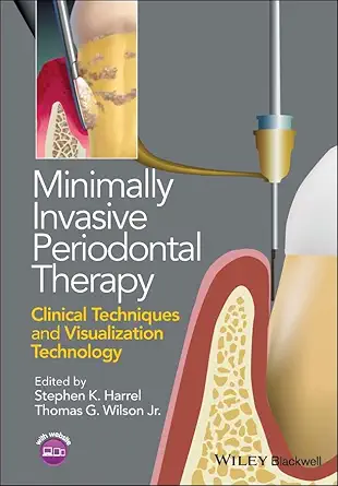 Buy Minimally Invasive Periodontal Therapy: Clinical Techniques and Visualization Technology (English, Paperback, Stephen K. Harrel, Thomas G. Wilson Jr.) Online at Best Price - GlowMirror
