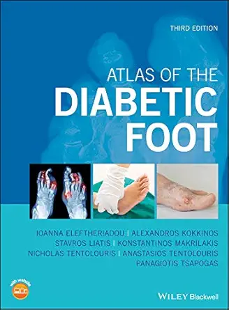 Buy Atlas of the Diabetic Foot (English, Paperback, Nikolaos Tentolouris, Konstantinos Makrilakis, Panagiotis Tsapogas, Stavros Liatis, Alexandros Kokk... Online at Best Price - GlowMirror