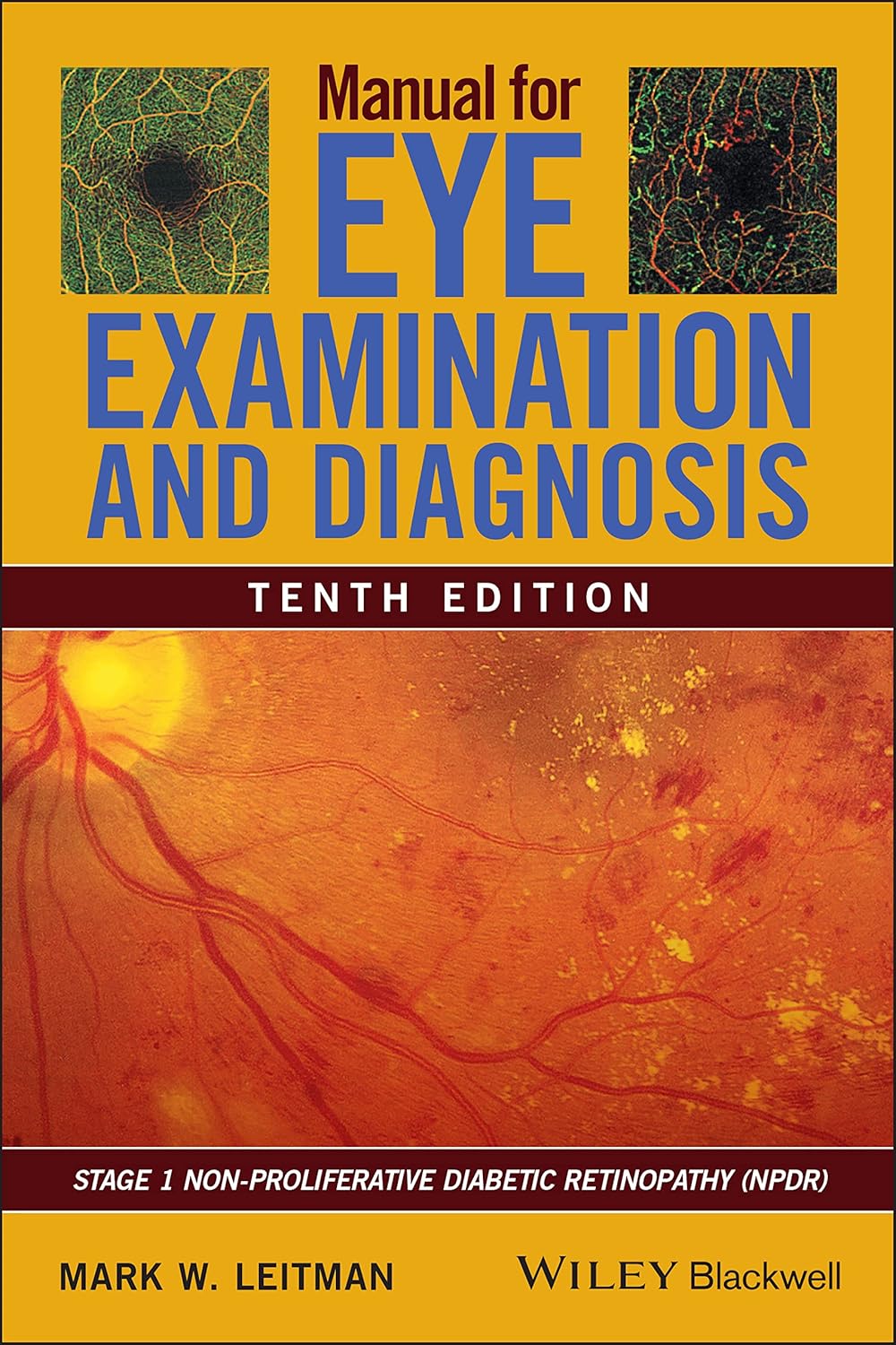 Buy Manual for Eye Examination and Diagnosis (English, Paperback, Mark W. Leitman) Online at Best Price - GlowMirror