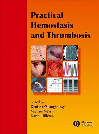 Buy Practical Hemostasis and Thrombosis (English, Paperback, Denise O′Shaughnessy, Michael Makris, David Lillicrap) Online at Best Price - GlowMirror
