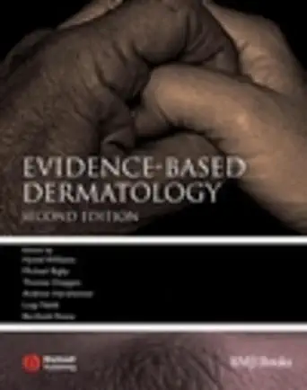 Buy Evidence–Based Dermatology (Evidence–Based Medicine) (English, Hardcover, Hywel Williams, Michael Bigby, Thomas Diepgen, Andrew Herxheimer, Luigi N... Online at Best Price - GlowMirror