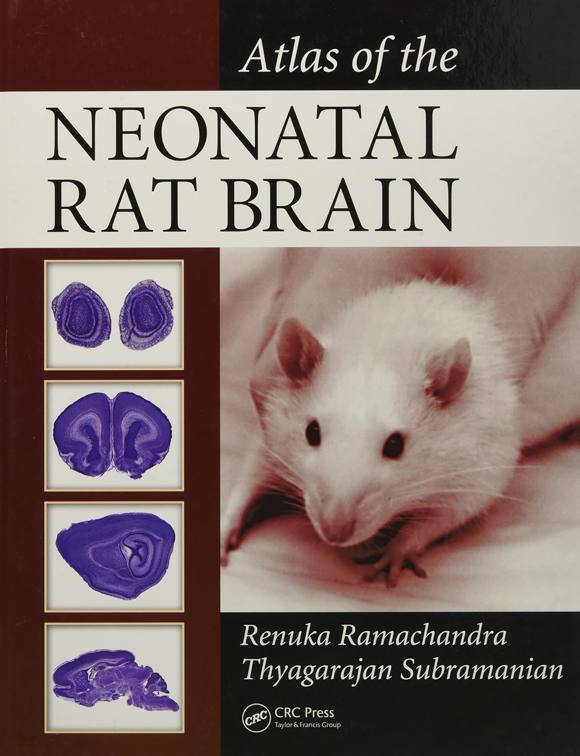 Buy Atlas of the Neonatal Rat Brain (English, Paperback, Renuka Ramachandra, Thyagarajan Subramanian) Online at Best Price - GlowMirror