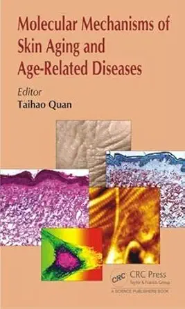 Buy Molecular Mechanisms of Skin Aging and Age-Related Diseases (English, Hardcover) Online at Best Price - GlowMirror