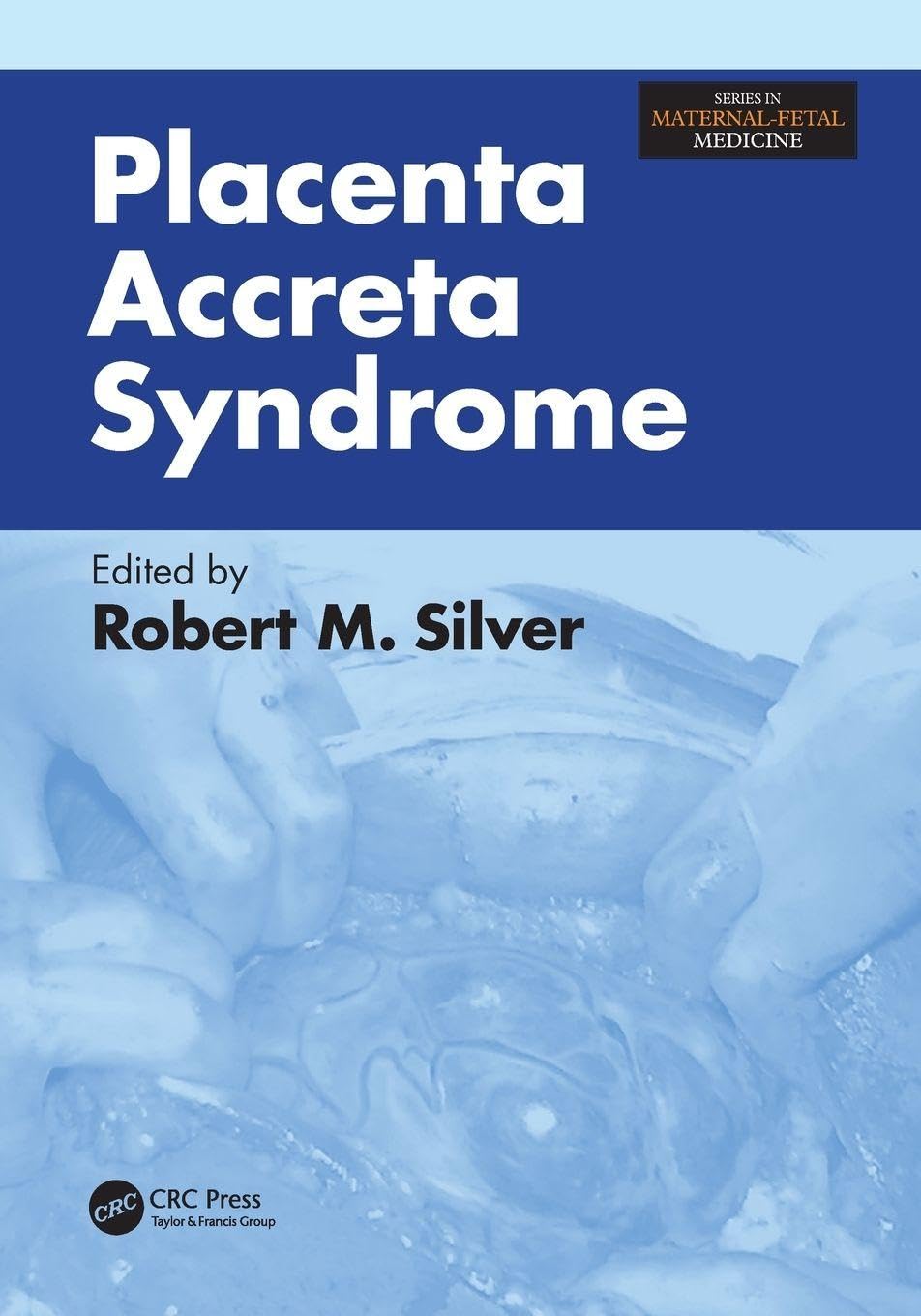 Buy Placenta Accreta Syndrome (Series in Maternal-Fetal Medicine) (English, Paperback, Robert Silver) Online at Best Price - GlowMirror