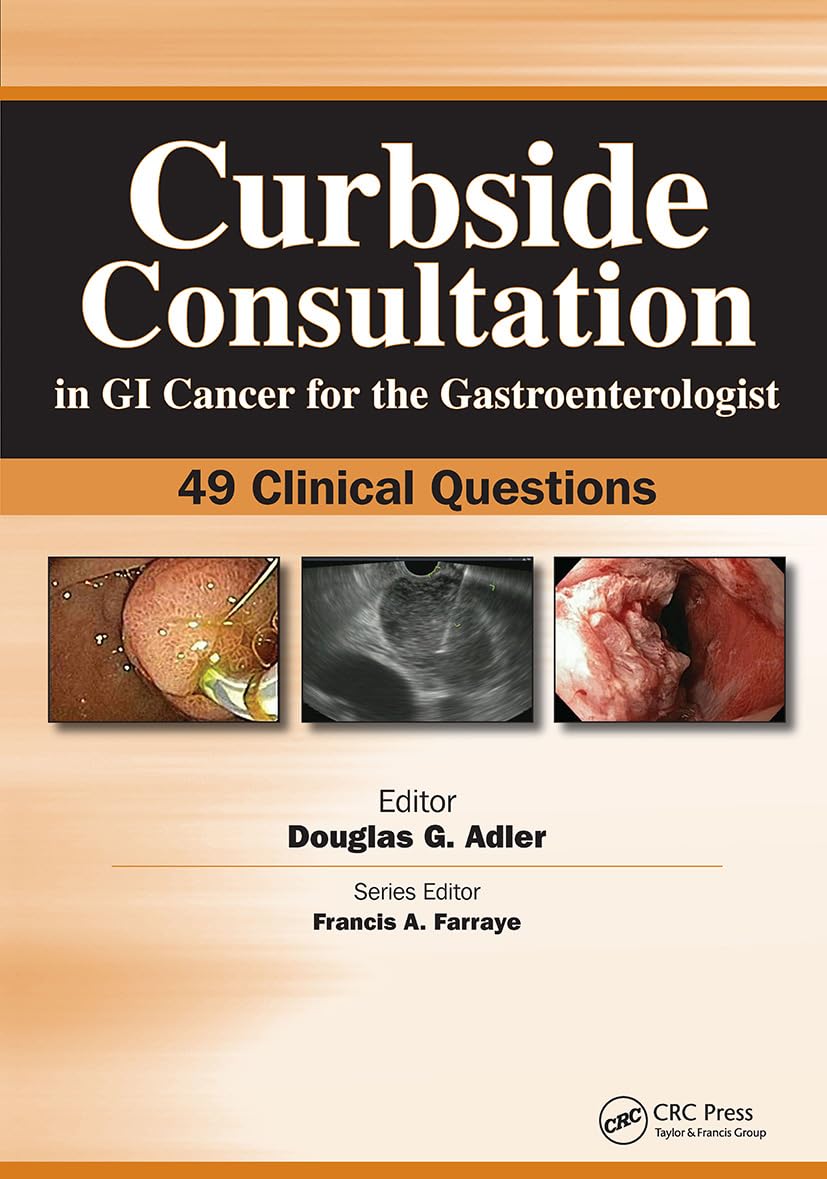 Buy Curbside Consultation in GI Cancer for the Gastroenterologist: 49 Clinical Questions (Curbside Consultation in Gastroenterology) (English, Paperbac... Online at Best Price - GlowMirror