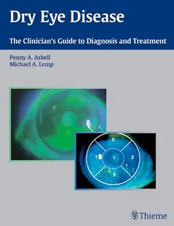 Buy Dry Eye Disease: The Clinician's Guide to Diagnosis and Treatment (English, Paperback, Penny A. Asbell) Online at Best Price - GlowMirror