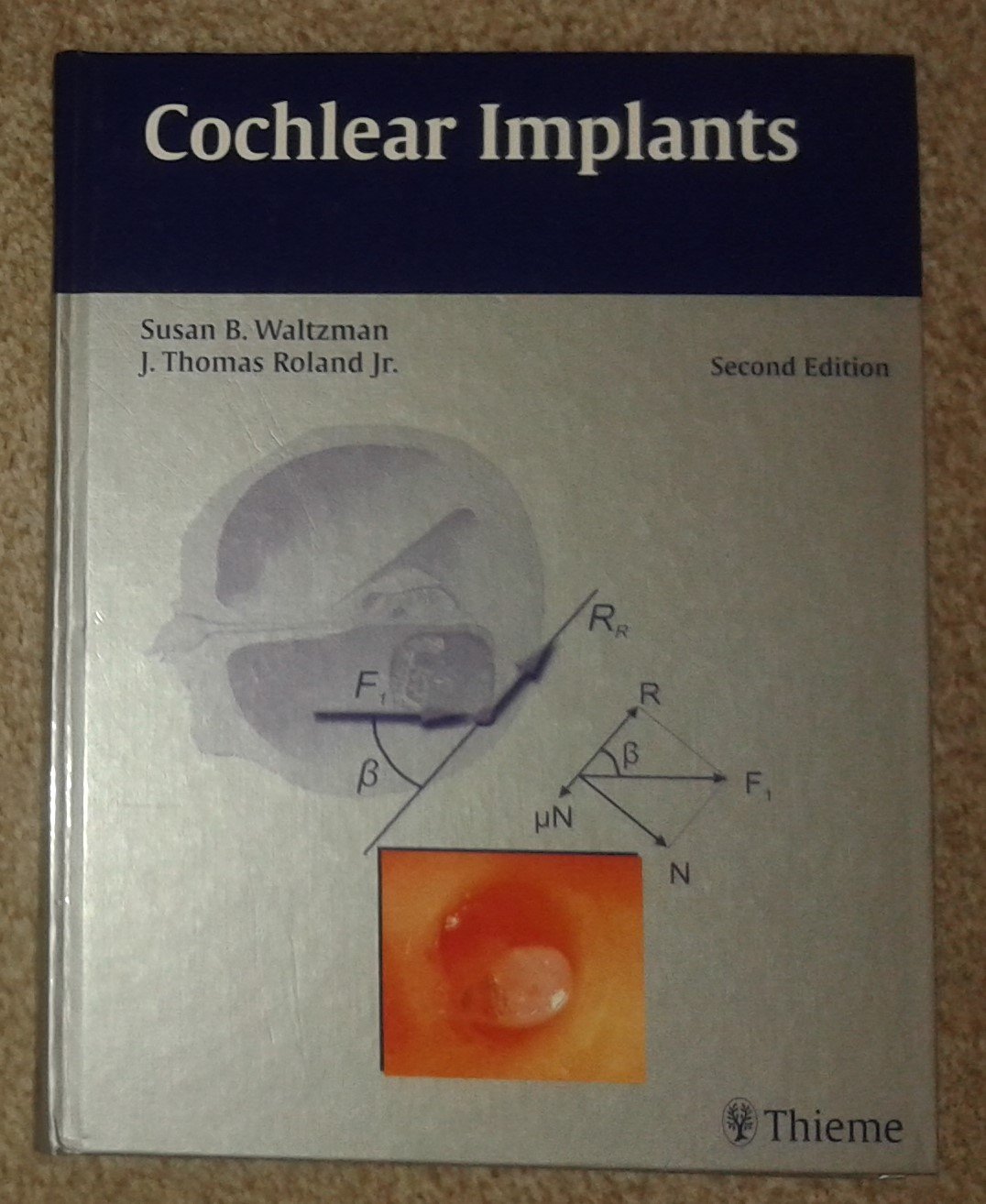 Buy Cochlear Implants (English, Hardcover, Susan B Waltzman, J Thomas Roland Jr.) Online at Best Price - GlowMirror