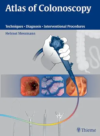 Buy Atlas of Colonoscopy: Techniques, Diagnosis, Interventional Procedures (English, Paperback, Jurgen Barnert, Max Bittinger, Thomas Eberl, M.D. Messm... Online at Best Price - GlowMirror
