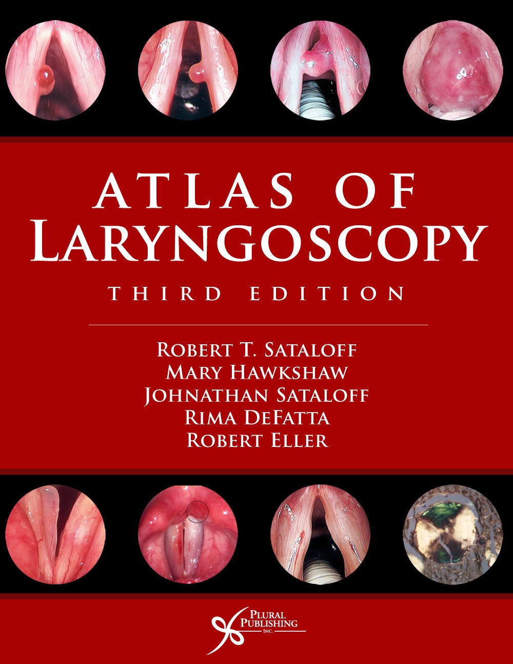 Buy ATLAS OF LARYNGOSCOPY (English, Hardcover, Robert T. Satalof) Online at Best Price - GlowMirror