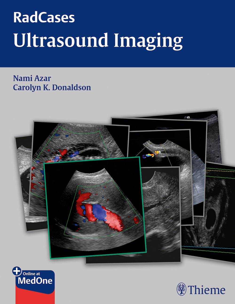 Buy Radcases Ultrasound Imaging (English, Paperback, Nami R. Azar) Online at Best Price - GlowMirror
