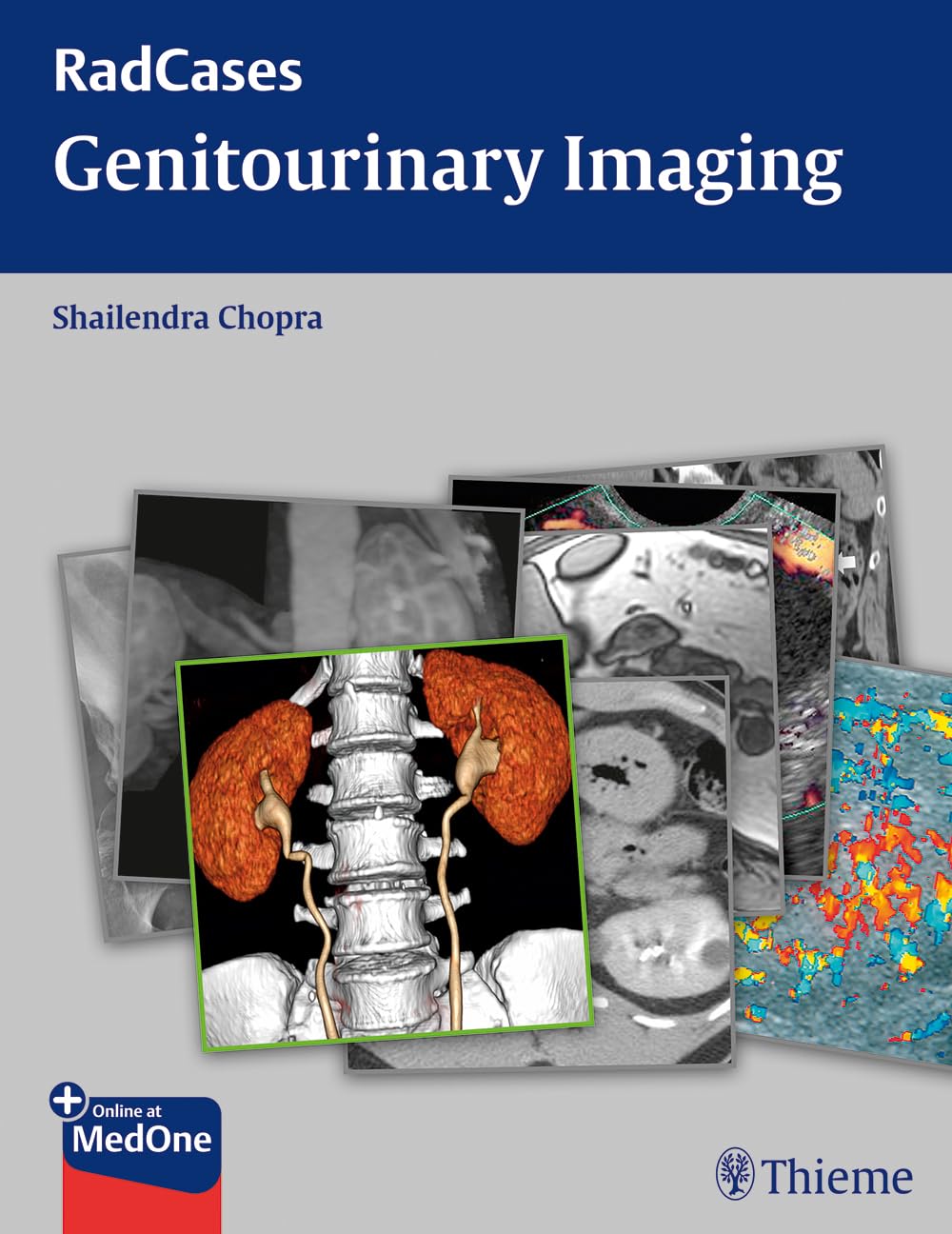Buy Genitourinary Imaging: RadCases (English, Paperback, Shailendra Chopra) Online at Best Price - GlowMirror
