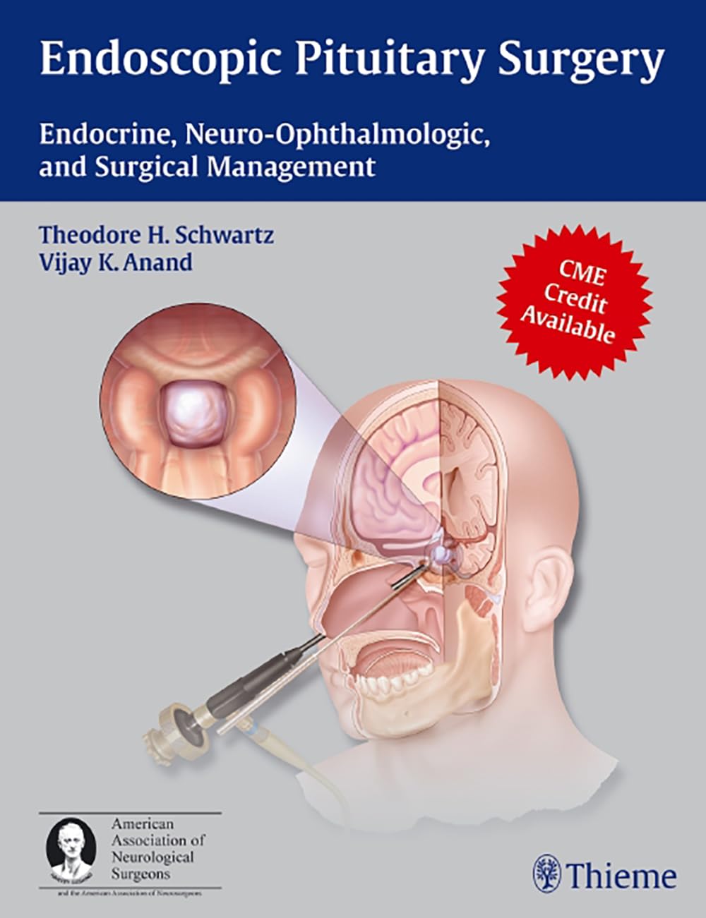 Buy Endoscopic Pituitary Surgery: Endocrine, Neuro-Ophthalmologic and Surgical Management (English, Paperback, Theodore H. Schwartz) Online at Best Price - GlowMirror
