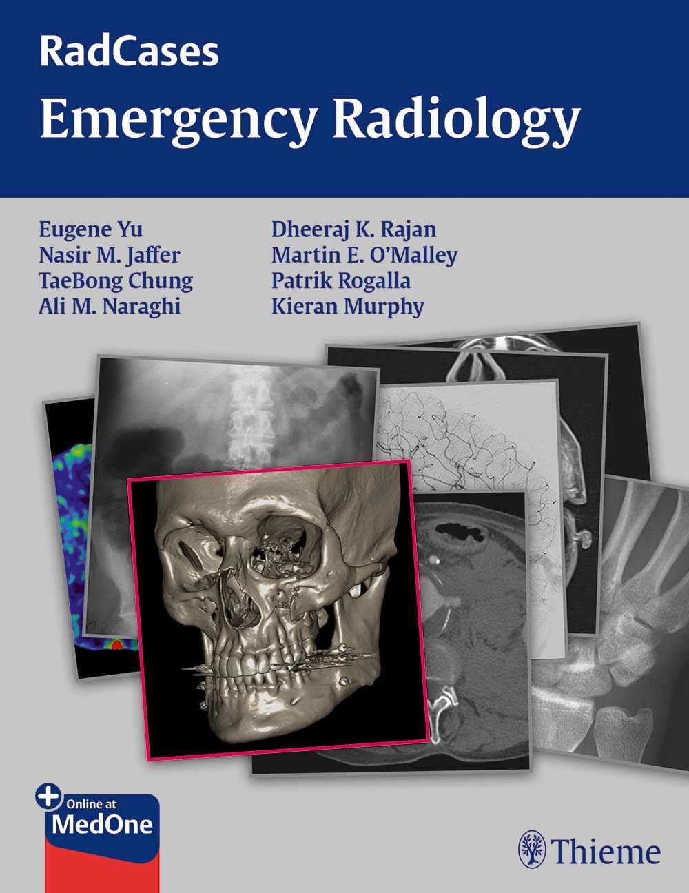 Buy Radcases Emergency Radiology (English, Paperback, Yu, Jaffer, Chung, Naraghi, Rajan, Murphy) Online at Best Price - GlowMirror