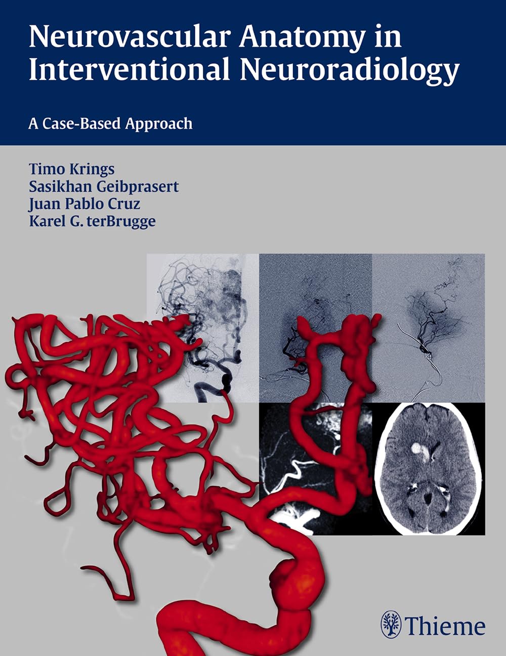 Buy Neurovascular Anatomy in Interventional Neuroradiology (English, Paperback, Timo Krings) Online at Best Price - GlowMirror