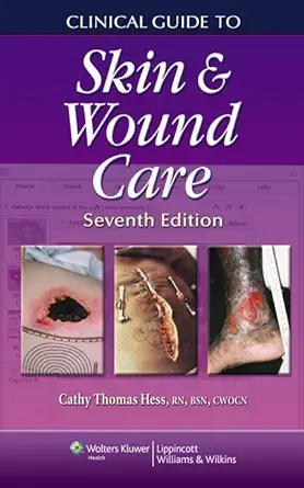 Buy Clinical Guide to Skin and Wound Care (English, Paperback, Cathy Thomas Hess RN BSN CWCN) Online at Best Price - GlowMirror