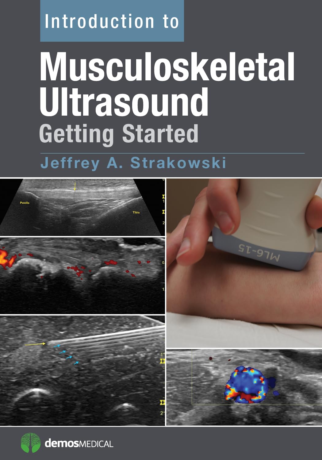 Buy Introduction to Musculoskeletal Ultrasound: Getting Started (English, Paperback, M.D. Strakowski, Jeffrey A.) Online at Best Price - GlowMirror