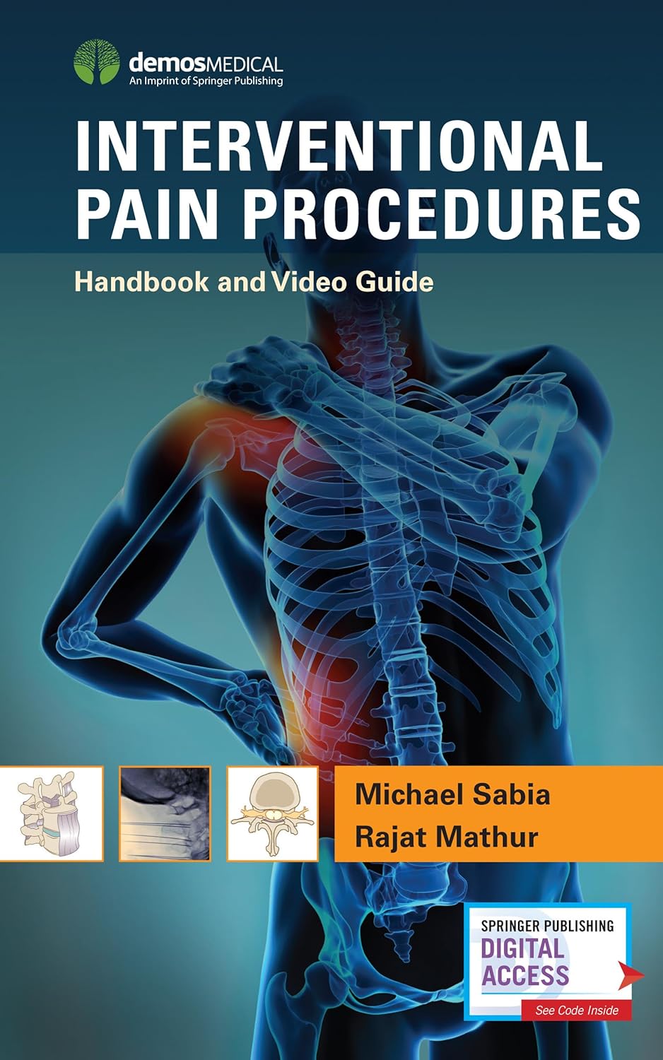 Buy Interventional Pain Procedures: Handbook and Video Guide (English, Paperback, M.d. Sabia, Michael, M.d. Mathur, Rajat) Online at Best Price - GlowMirror