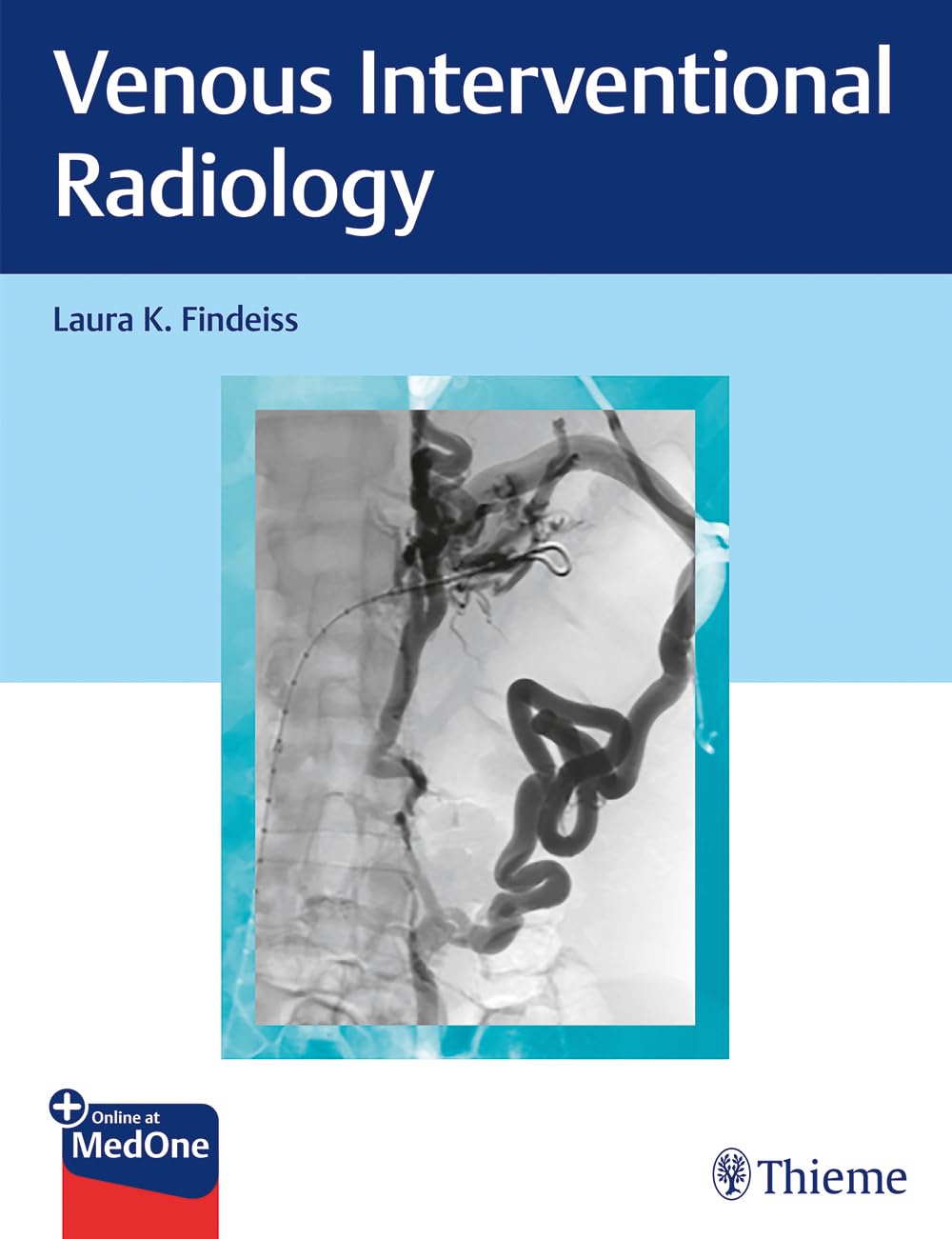 Buy Venous Interventional Radiology (English, Paperback, Laura K. Findeiss) Online at Best Price - GlowMirror