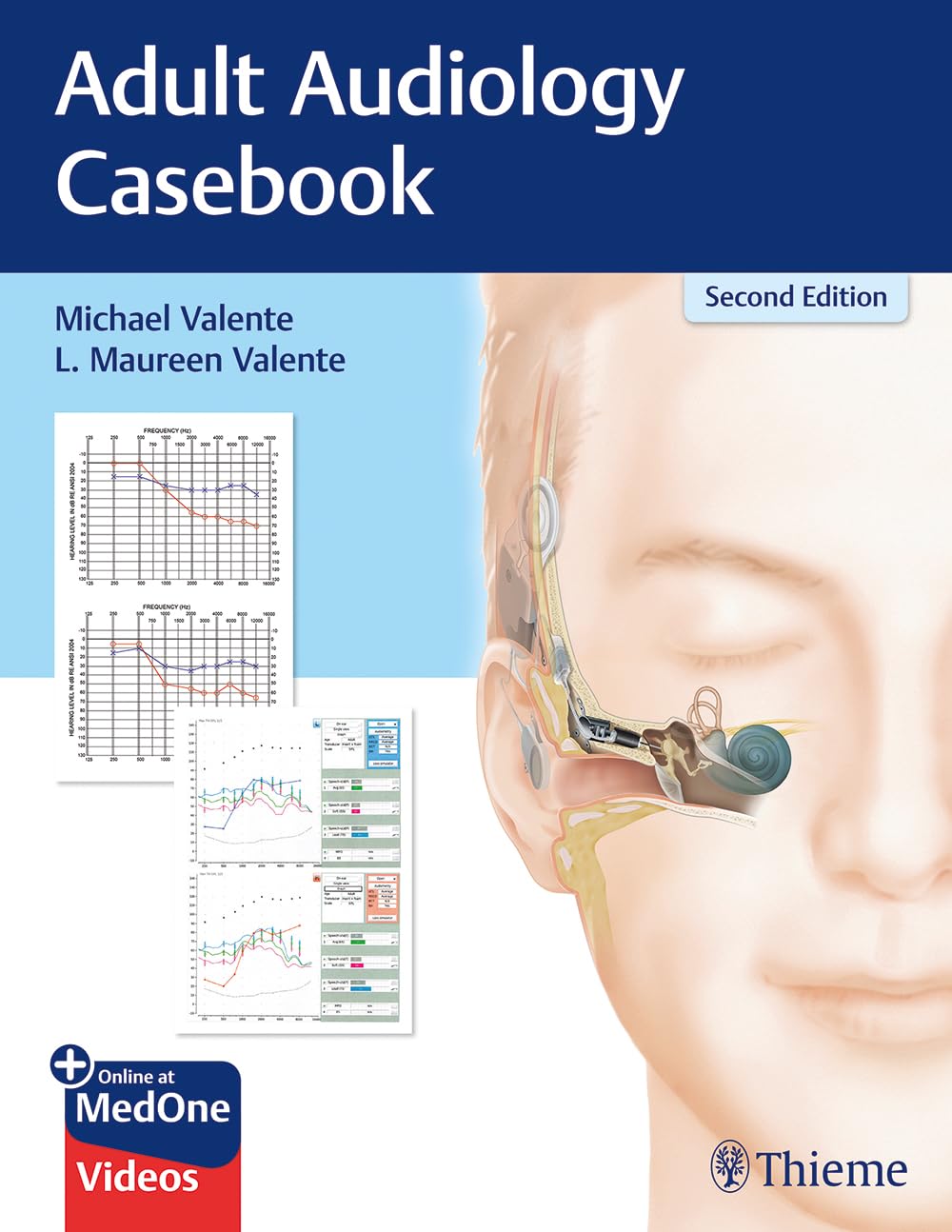 Buy Adult Audiology CasPaperback (English, Paperback, Valente) Online at Best Price - GlowMirror