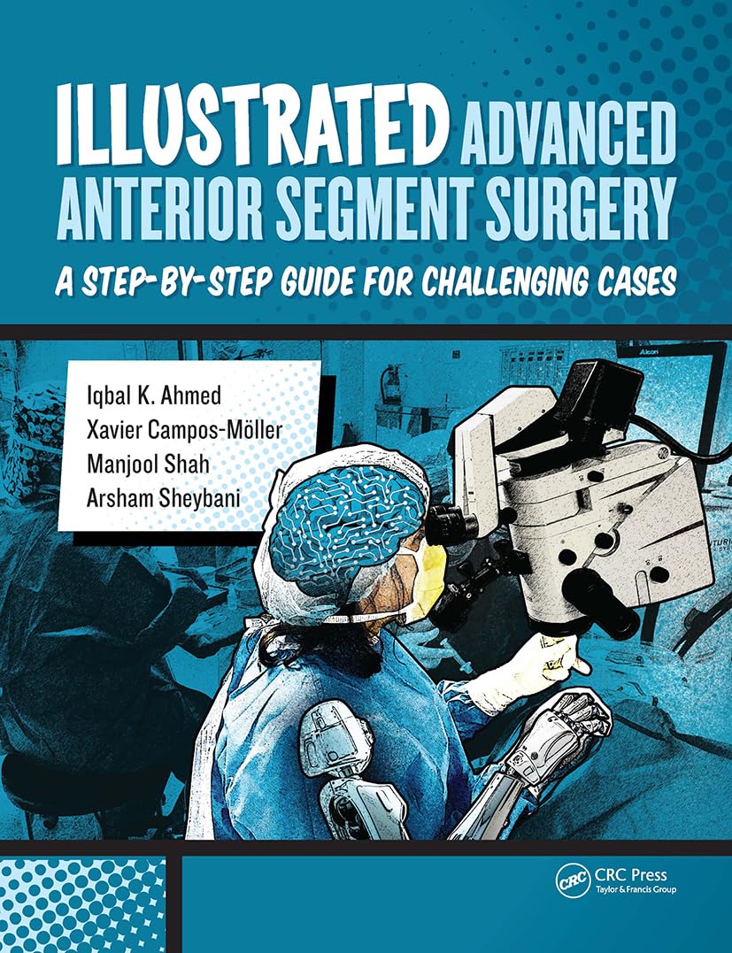 Buy Illustrated Advanced Anterior Segment Surgery: A Step-by-Step Guide for Challenging Cases (English, Paperback, Iqbal Ahmed, Xavier Möller, Manjool ... Online at Best Price - GlowMirror