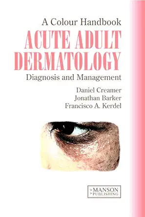 Buy Acute Adult Dermatology: Diagnosis and Management: Diagnosis and Management: A Colour Handbook (English, Paperback, Daniel Creamer, Jonathan Barker... Online at Best Price - GlowMirror