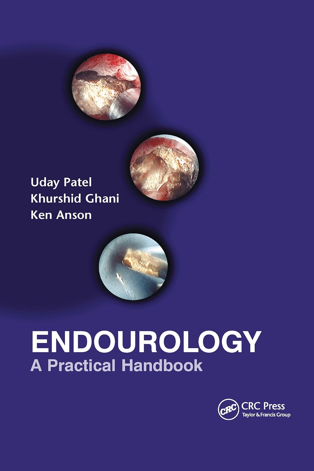 Buy Endourology: A Practical Handbook (English, Hardcover, Uday Patel, Kenneth M. Anson, Khurshid Ghani) Online at Best Price - GlowMirror