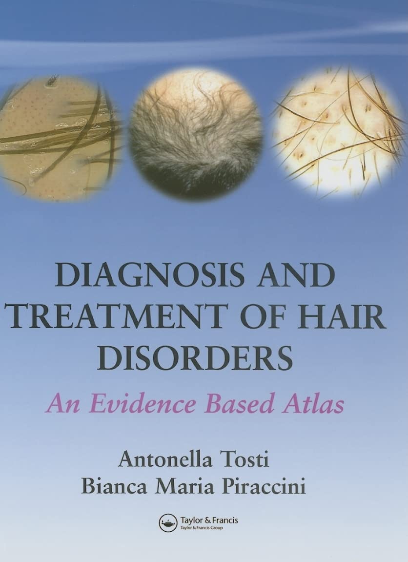 Buy Diagnosis And Treatment Of Hair Disorders: An Evidence Based Atlas (English, Paperback, Antonella Tosti, Bianca Maria Piraccini) Online at Best Price - GlowMirror