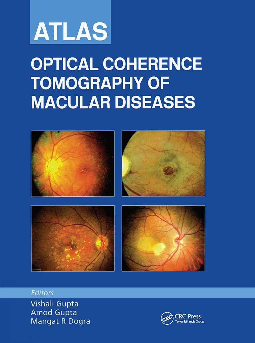 Buy (ORG)Atlas OF Optical Coherence Tomography OF Macular Diseases, 1/ED (English, Hardcover, Vishali Gupta, Amod Gupta, Mangat R. Dogra) Online at Best Price - GlowMirror