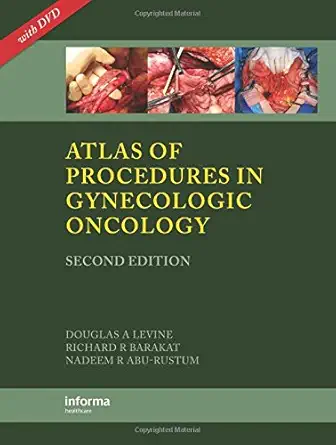 Buy Atlas of Procedures in Gynecologic Oncology, Second Edition (English, Hardcover, Nadeem R. Abu-Rustum, Richard R. Barakat, Douglas A. Levine) Online at Best Price - GlowMirror