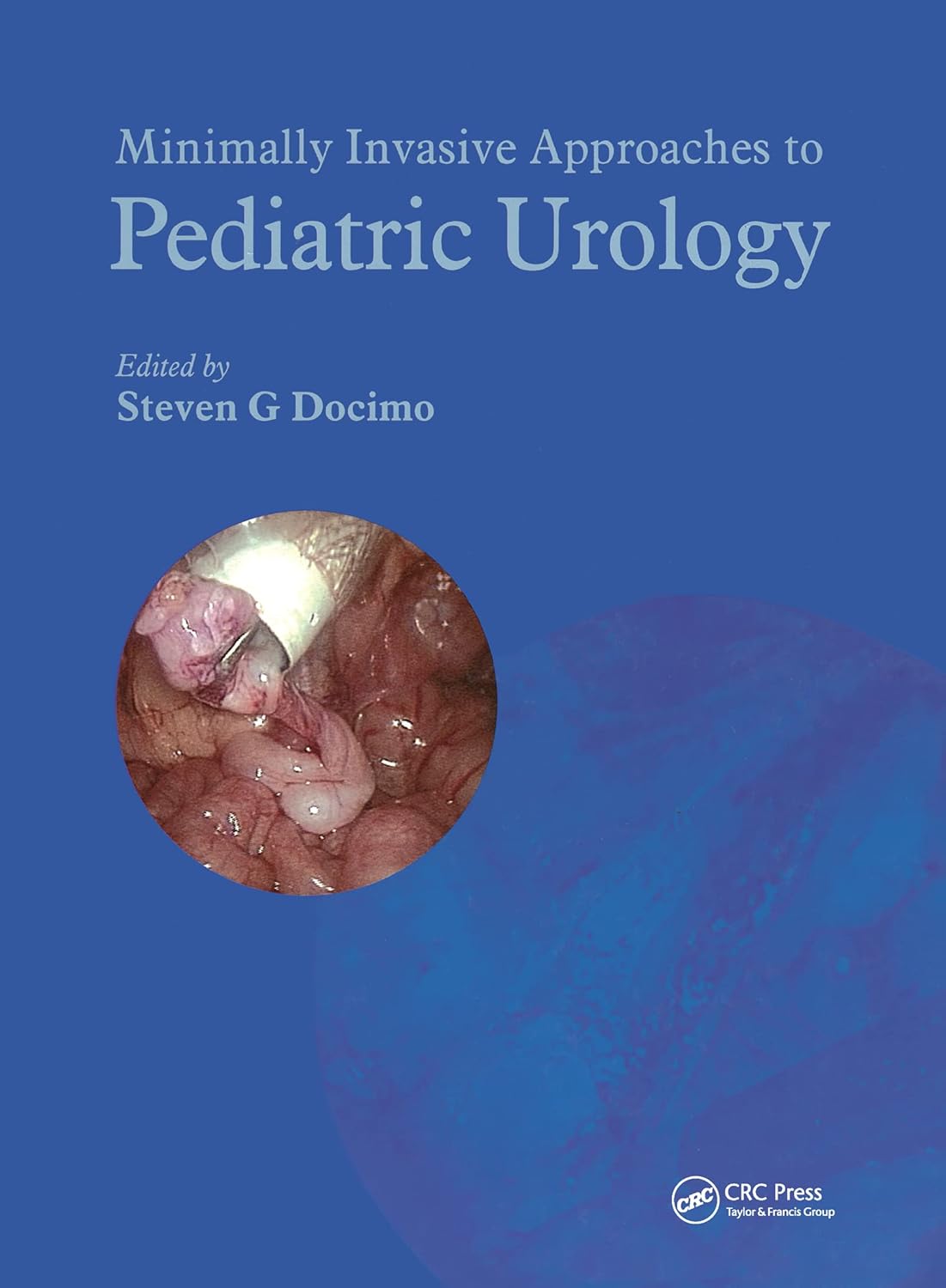 Buy Minimally Invasive Approaches To Pediatric Urology (English, Hardcover, Steven G. Docimo) Online at Best Price - GlowMirror