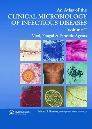 Buy AN ATLAS OF CLINICAL MICROBIOLOGY OF INFECTIOUS DISEASES VOL.2: Viral, Fungal, and Parasitic Agents (Encyclopedia of Visual Medicine Series) (Engli... Online at Best Price - GlowMirror