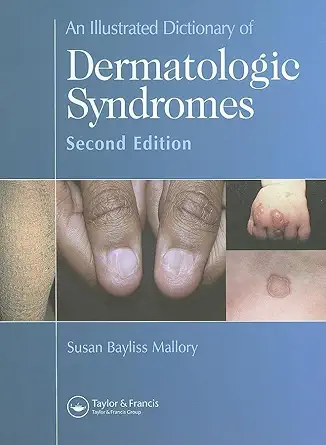 Buy AN Illustrated Dictionary OF Dermatologic Syndromes 2/E (English, Paperback, Susan B. Mallory) Online at Best Price - GlowMirror