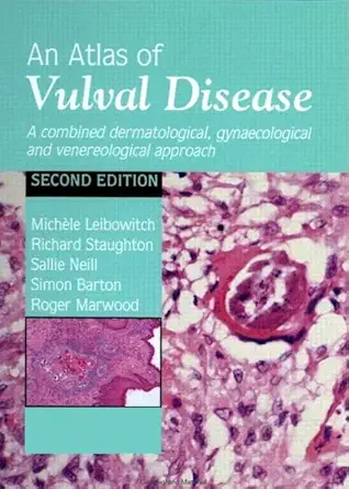 Buy An Atlas of Vulval Disease: A Combined Dermatological, Gynaecological and Venereological Approach (English, Hardcover, Michèle Leibowitch, Richard ... Online at Best Price - GlowMirror