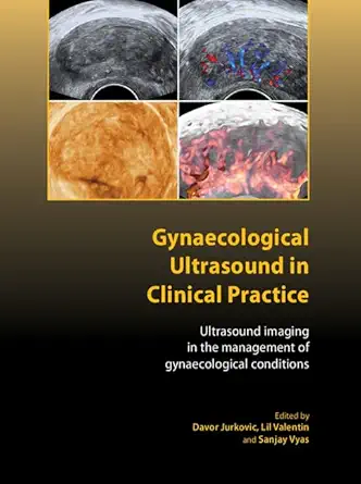 Buy Gynaecological Ultrasound in Clinical Practice: Ultrasound Imaging in the Management of Gynaecological Conditions (Royal College of Obstetricians a... Online at Best Price - GlowMirror
