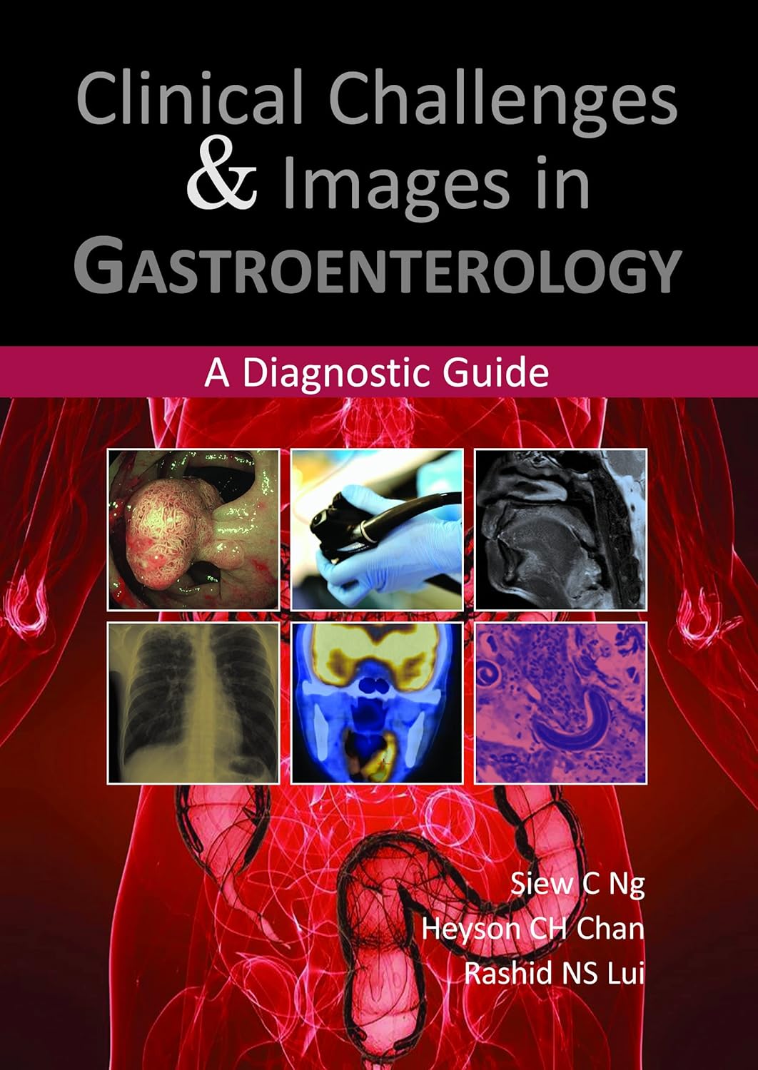 Buy Clinical Challenges & Images in Gastroenterology: A Diagnostic Guide (English, Paperback, Siew C. Ng, Heyson C. H. Chan, Rashid N. S. Lui) Online at Best Price - GlowMirror