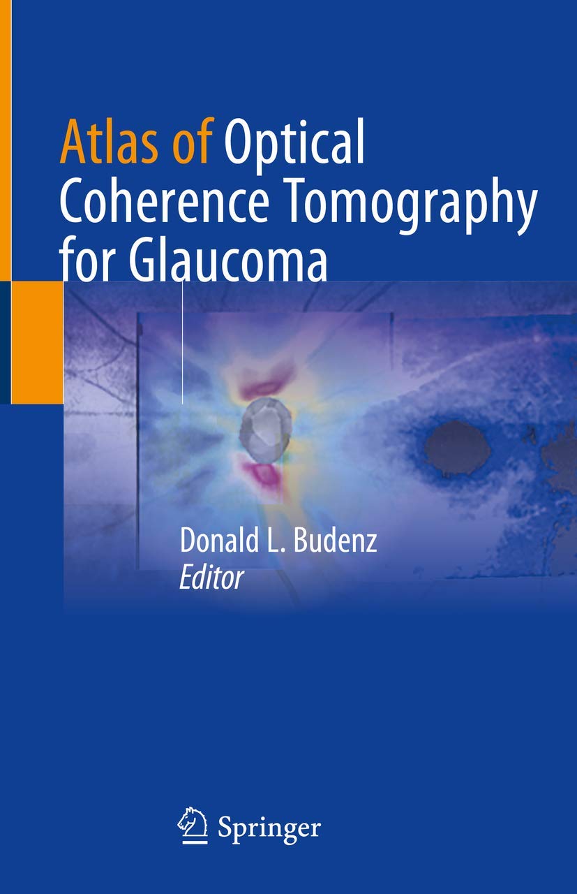 Buy Atlas OF Optical Coherence Tomography FOR Glaucoma (HB 2020) (English, Paperback, Budenz D.L.) Online at Best Price - GlowMirror