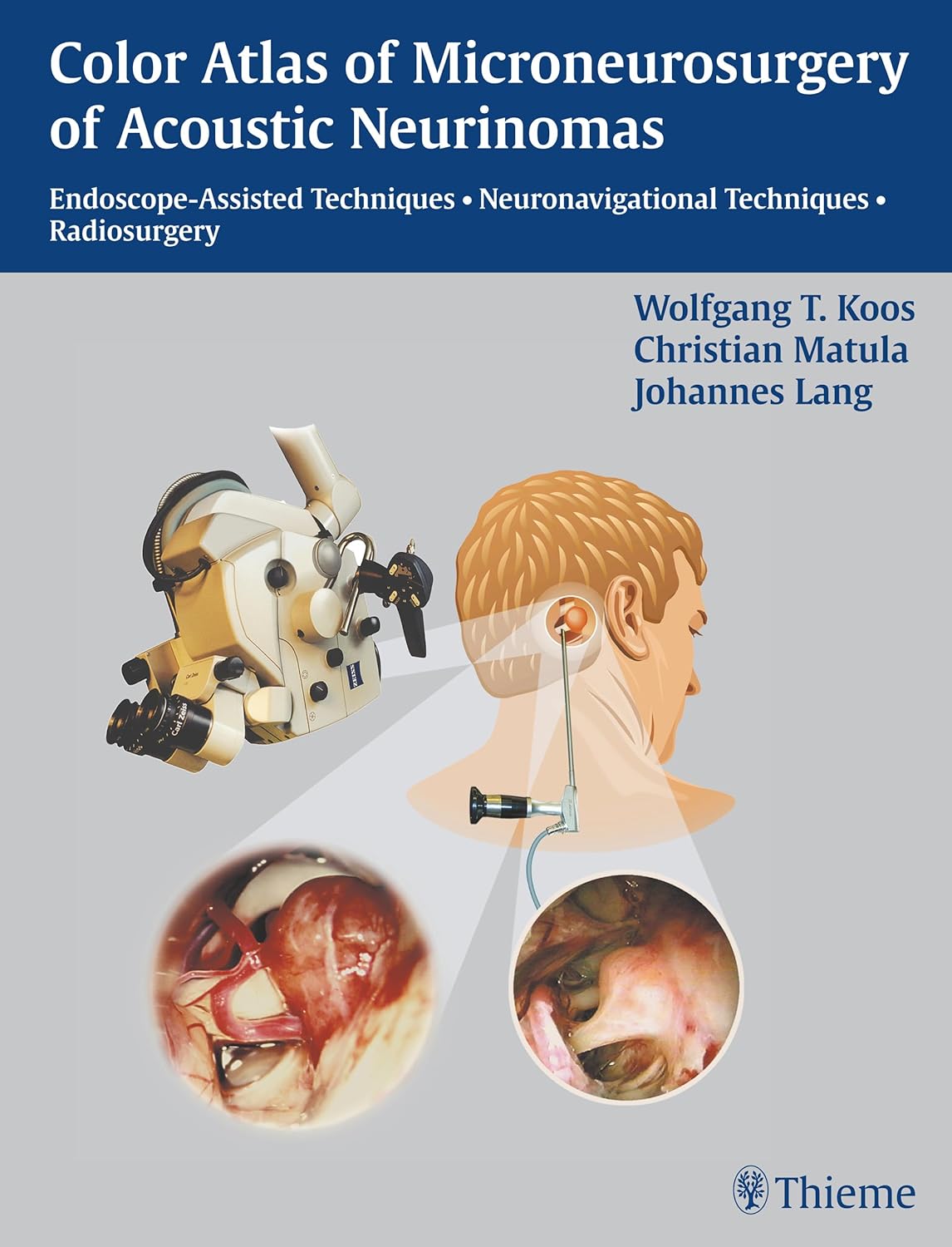 Buy Color Atlas of Microneurosurgery of Acoustic Neurinomas (English, Paperback, W. Koos) Online at Best Price - GlowMirror