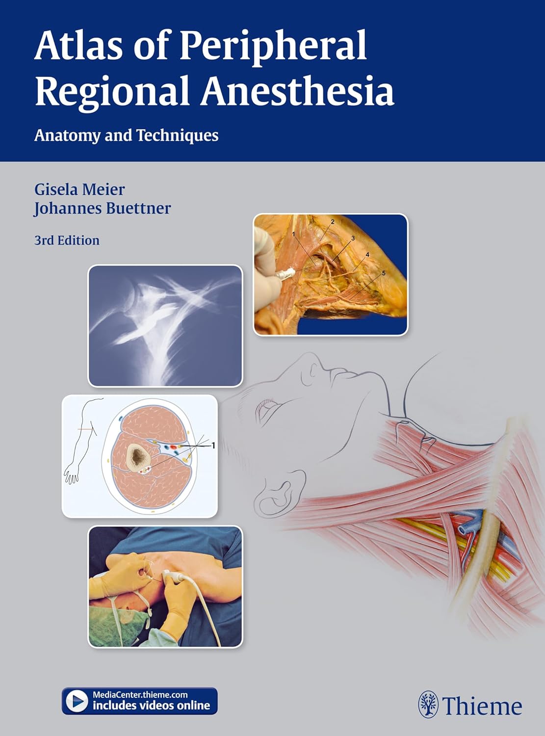 Buy Atlas of Peripheral Regional Anesthesia: Anatomy and Techniques (English, Paperback, Gisela Meier, Johannes Buettner, Johannes Buttner) Online at Best Price - GlowMirror