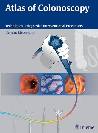 Buy Atlas of Colonoscopy: Examination Techniques and Diagnosis (English, Paperback, Helmut Messmann) Online at Best Price - GlowMirror