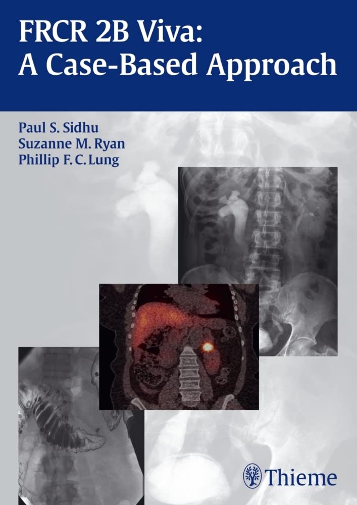 Buy Frcr 2B Viva: A Case-Based Approach: 1/E (English, Paperback, Paul S. Sidhu) Online at Best Price - GlowMirror